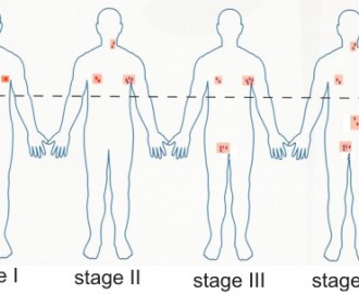 stages_hl
